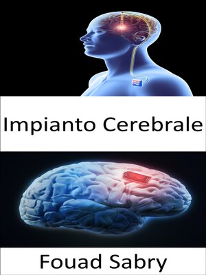cover image of Impianto Cerebrale